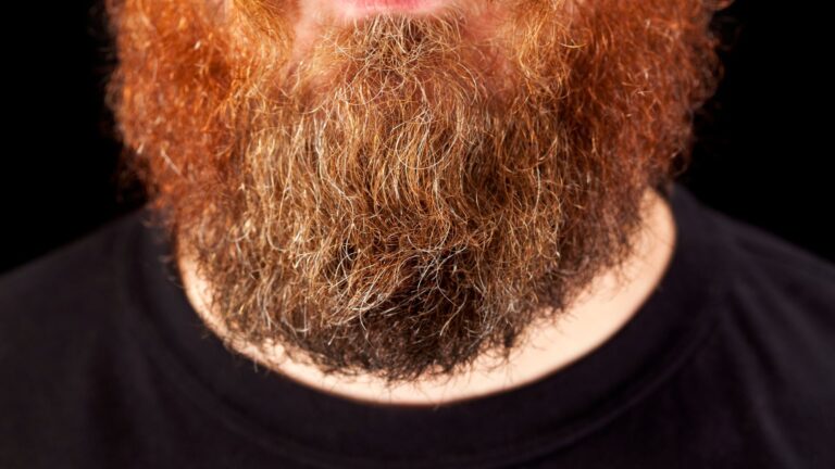 Rude brody – dlaczego niektórzy bruneci i blondyni je mają?