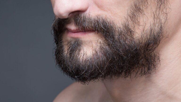 Dziury w brodzie – jak się ich pozbyć?