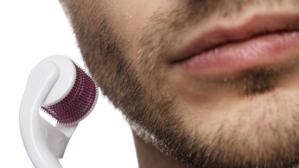 Mezoterapia - Nakłuwanie skóry twarzy na porost brody